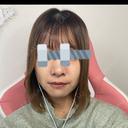 糸リフト / ヒアルロン酸注入（あご） / ボトックス（エラ・小顔） / 脂肪溶解注射（顔） 大阪TAクリニック BEFORE サムネイル用