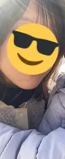 ハイフ（顔） / ハイフ（首） TCB東京中央美容外科 熊本院 BEFORE サムネイル用