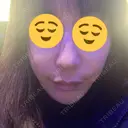 糸リフト / 脂肪吸引（顔） / ボトックス（エラ・小顔） / ヒアルロン酸注入（頬） Tokyo Tensei Clinic 新宿院 BEFORE サムネイル用