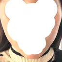 糸リフト 福岡TAクリニック BEFORE サムネイル用