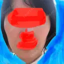 骨削り（エラ） / 骨削り（頬） ボンディ美容整形外科（旧リオン整形外科） BEFORE サムネイル用