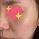 ルメッカ BIANCA表参道 BEFORE サムネイル用