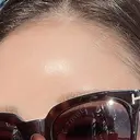 ボトックス（額） ルラ美容クリニック銀座院 BEFORE サムネイル用
