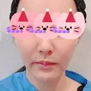 糸リフト / 脂肪吸引（顔） 東京美専クリニック BEFORE サムネイル用