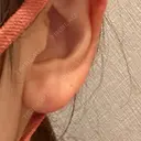 ピアス穴あけ 新宿ラクル美容外科クリニック 六本木院 BEFORE サムネイル用