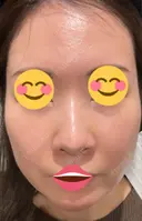 ポテンツァ 9BeautyClinic BEFORE サムネイル用