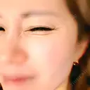 ボトックス（あご） / ボトックス（エラ・小顔） / ボトックス（口角） / ボトックス（タレ目） / シワ取りボトックス / ボトックス（眉間） / ボトックス（目尻） / ボトックス（額） / ボトックス（人中） Brandnew Beauty Clinic BEFORE サムネイル用