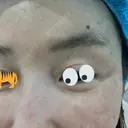 ベビーコラーゲン / サーマクール 新宿ラクル美容外科クリニック 新宿院 BEFORE サムネイル用