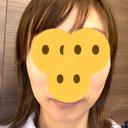 ボトックス（エラ・小顔） Wi Clinic（ウィ クリニック） 吉祥寺院 BEFORE サムネイル用