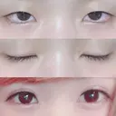 二重埋没 湘南美容クリニック 長野院 BEFORE サムネイル用