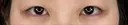 二重切開 / 目頭切開 / 上まぶたたるみ取り アリエル美容クリニック 大宮院 BEFORE サムネイル用