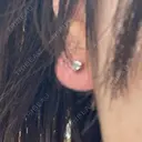 ピアス穴あけ 渋谷美容外科クリニック 横浜院 BEFORE サムネイル用