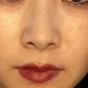 小鼻縮小（切開） 山本クリニック BEFORE サムネイル用