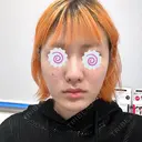 切開リフト 東京エビスクリニック BEFORE サムネイル用