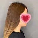 脂肪吸引（顔） R Beauty CLINIC 銀座院 BEFORE サムネイル用