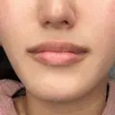 アートメイク（唇） Brandnew Beauty Clinic BEFORE サムネイル用