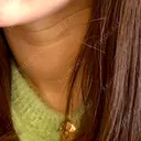 PRP皮膚再生療法 ノリス美容クリニック BEFORE サムネイル用