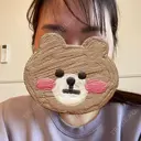 タトゥー除去 渋谷美容外科クリニック 池袋院 BEFORE サムネイル用