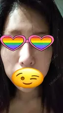 鼻尖形成（切開） / 軟骨移植 表参道スキンクリニック 表参道院 BEFORE サムネイル用