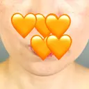 糸リフト アリエル美容クリニック 郡山院 BEFORE サムネイル用