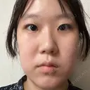 二重埋没 / 目頭切開 Olino美容外科・美容皮膚科 BEFORE サムネイル用