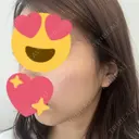 ピコレーザートーニング（美白・肝斑） / レーザートーニング（美白・肝斑） ルラ美容クリニック 渋谷本院 BEFORE サムネイル用