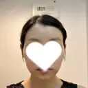 額を丸く / 脂肪吸引（二の腕） / こめかみ形成 / 脂肪注入（額） / 脂肪吸引（肩） / 脂肪注入（輪郭） Mods Clinic（モッズクリニック） 名古屋院 BEFORE サムネイル用