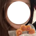 ボトックス（エラ・小顔） 湘南美容クリニック 本厚木院 BEFORE サムネイル用