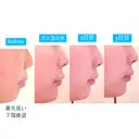 ヒアルロン酸注入（鼻） / ヒアルロン酸注入（あご） / ヒアルロン酸注入（唇） ヴェリテクリニック 大阪院 BEFORE サムネイル用