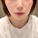 インディバ（顔） WOM SALON【術後ケア取扱いサロン】 BEFORE サムネイル用