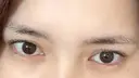 ヒアルロン酸注入（涙袋） ファイヤークリニック 渋谷院 BEFORE サムネイル用