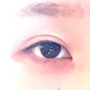 その他（目元） グリシーヌクリニック BEFORE サムネイル用