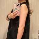 脂肪吸引（二の腕） 湘南美容クリニック 京都院 BEFORE サムネイル用