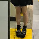 ボトックス（ふくらはぎ） ビューティースキンクリニック 池袋院 BEFORE サムネイル用