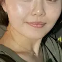 糸リフト / 脂肪吸引（顔） / ヒアルロン酸注入（唇） 仙台TAクリニック BEFORE サムネイル用