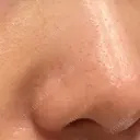 ポテンツァ 9BeautyClinic BEFORE サムネイル用
