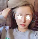 骨切り（あご） / 骨削り（エラ） / 骨削り（頬） / 脂肪吸引（顔） / ヒアルロン酸溶解 View美容整形外科 BEFORE サムネイル用