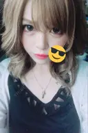 ヒアルロン酸注入（鼻） / ヒアルロン酸注入（頬） 銀座国際美容外科 池袋院 BEFORE サムネイル用