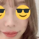 スレッドノーズ / 鼻中隔延長（非切開） ASTRA BEAUTY CLINIC BEFORE サムネイル用