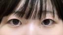 二重埋没 / 目頭切開 東京シンデレラ美容外科 池袋院 BEFORE サムネイル用