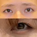 目尻切開 / タレ目形成・グラマラスライン（埋没） / 美容点滴・美容注射（美肌） LOUIS CLINIC 二子玉川院【ルイクリニック】 BEFORE サムネイル用