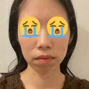 セットバック カトレア歯科・美容クリニック BEFORE サムネイル用