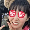 糸リフト / 脂肪吸引（顔） / メーラーファット除去 BLINC CLINIC （ブリンク クリニック） BEFORE サムネイル用