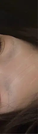 アートメイク（眉） NARU Beauty Clinic 【ナルクリ】 水戸院 BEFORE サムネイル用