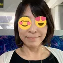 ハイフ（顔） ASTRA BEAUTY CLINIC BEFORE サムネイル用