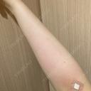 白玉点滴・注射 HAAB BEAUTY CLINIC 名古屋院 BEFORE サムネイル用