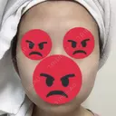 バッカルファット除去 / 脂肪吸引（顔） / ヒアルロン酸注入（あご） / ボトックス（エラ・小顔） エートップ美容整形外科 BEFORE サムネイル用