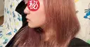 ボトックス（あご） / ヒアルロン酸注入（あご） EMMO FACE CLINIC 東京三田院 BEFORE サムネイル用