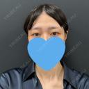 二重埋没 / クマ治療 湘南美容クリニック 西葛西院 BEFORE サムネイル用