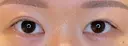 目尻切開 / タレ目形成・グラマラスライン（埋没） LOUIS CLINIC 二子玉川院【ルイクリニック】 BEFORE サムネイル用